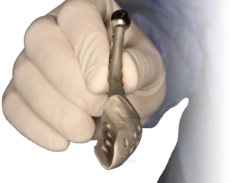 Surgeon holding patient specific partial mandibular prosthesis